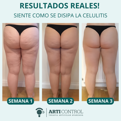 Arti Control Glowroll | Tu Verano Sin Celulitis a Un Click!